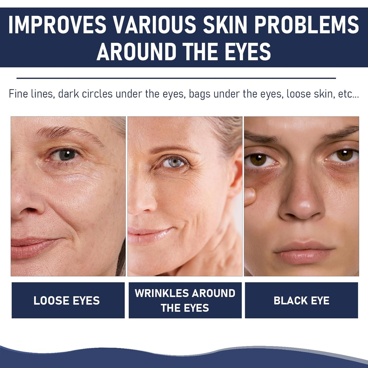 Rapid Reduction Eye Serum, Advanced Formula Instant Eye Serum, Anti Aging Serum Visibly Reduces Under-eye Bags, Nourishing Eye Serum, Suitable For All Skin Type (2Pcs)